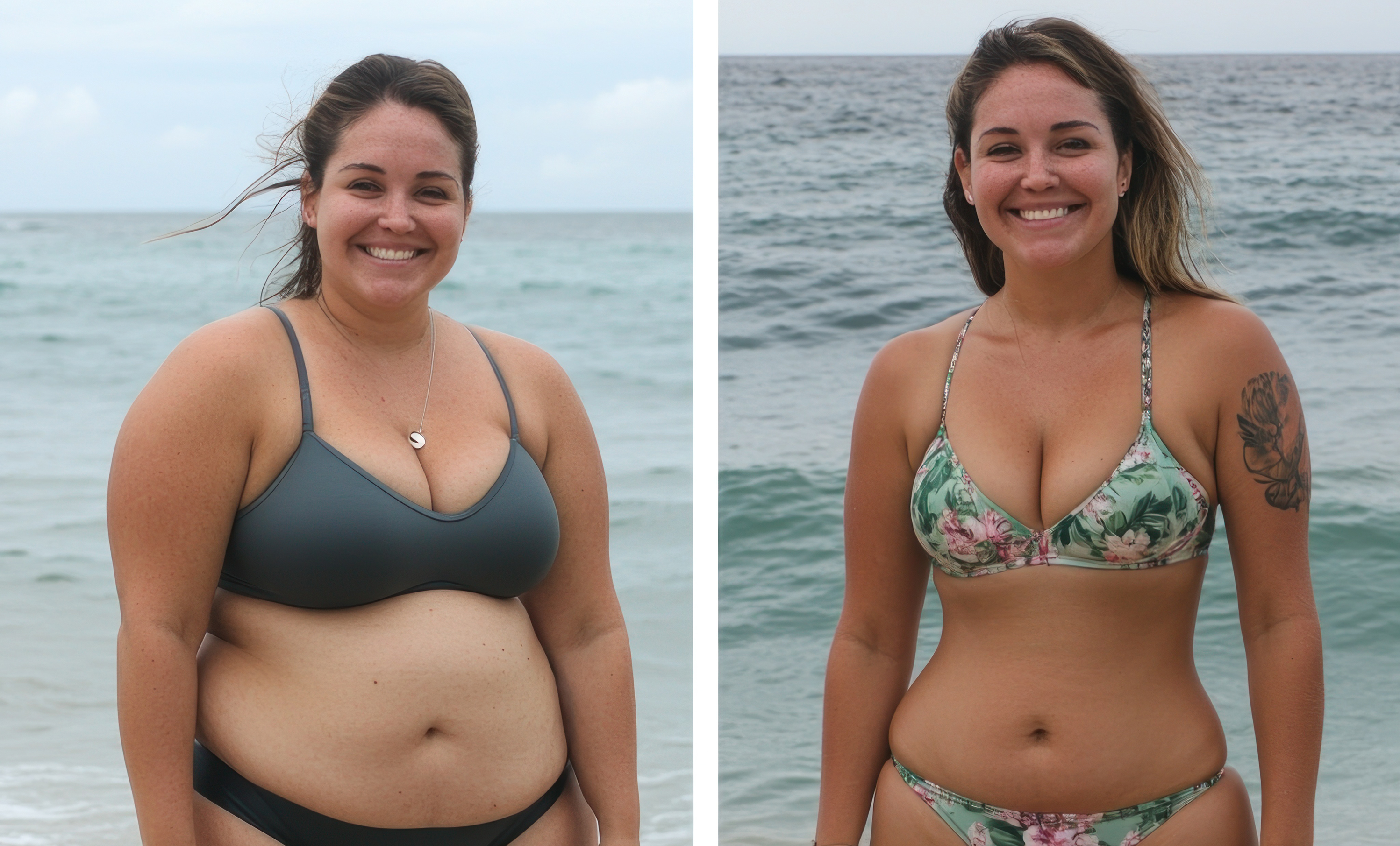 The Surprising Connection Between Gut Health and Weight Gain